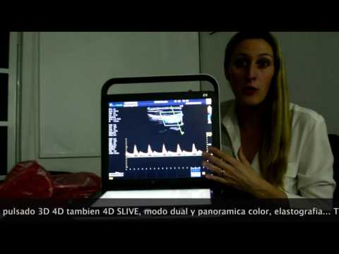 Dillies Medical - Sonoscape S9 Touch