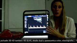 Dillies Medical - Sonoscape S9 Touch