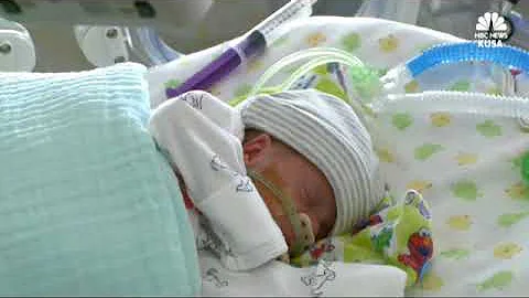 NICU Cameras Help Families Bond