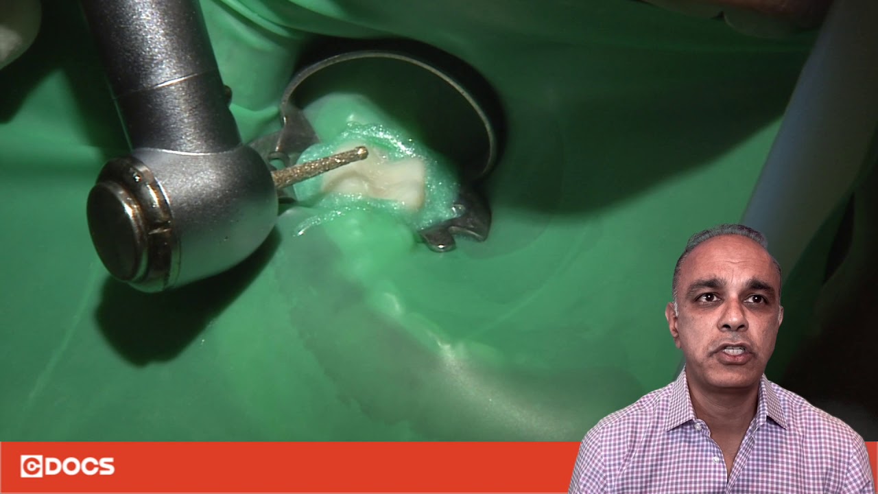 Tip of the Day: Access Burs for Endo