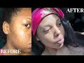 HOW I CLEARED MY SKIN| SKIN CARE ROUTINE| DESTINY&#39;S JOY