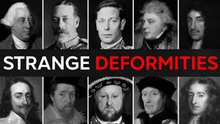 Famous *No ads* 25 BRITISH Kings and Queens With SECRET Disabilities And Deformities | For Sleep Profile