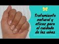 Remedio casero para que  las uñas crezcan rápido, fuertes y sanas