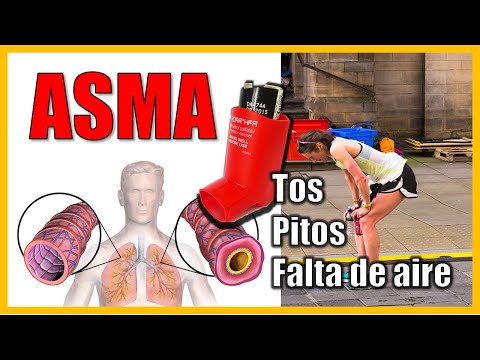 ¿Cómo hacer EJERCICIO si tengo ASMA? | How to exercise with asthma?