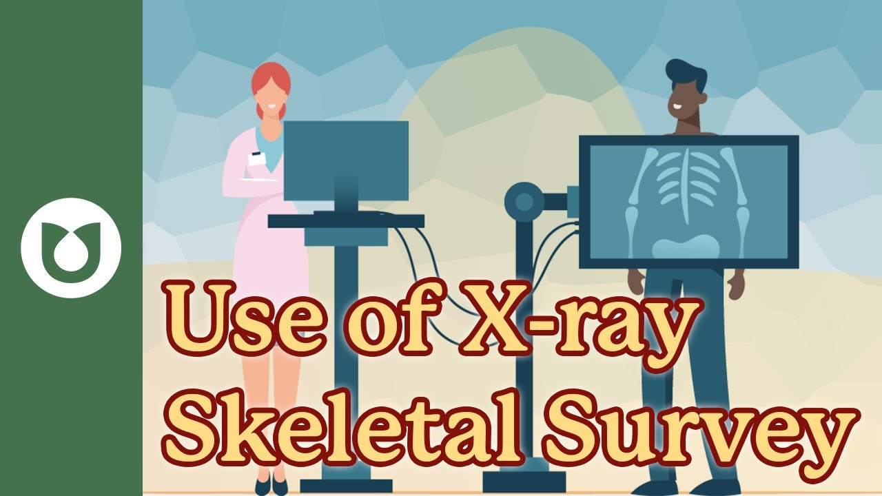 What should I know about the use of X-ray skeletal survey in myeloma? # ...