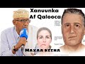 FARIIN CAAFIMAAD Xanuunka Af Qalooca Waxa Sababa Iyo Habka Loo Daaweeyo Dr Bashiir Cali Biixi