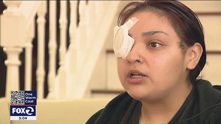 Antioch fast-food manager speaks out after losing eye while defending special-needs teen