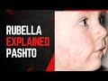 Rubella (German Measles)Epidemiology, Clinical Manifestations, and Vaccination Strategies in pashto