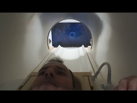 Video: ¿Las resonancias magnéticas son claustrofóbicas?