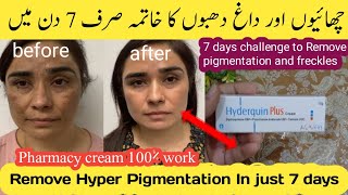 Remove Face Pigmentation 100%effective | chaiyon ko khatam karny ka tariqa😱[Hyderquin Plus]