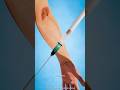 How the Injection Works⁉️ #shorts