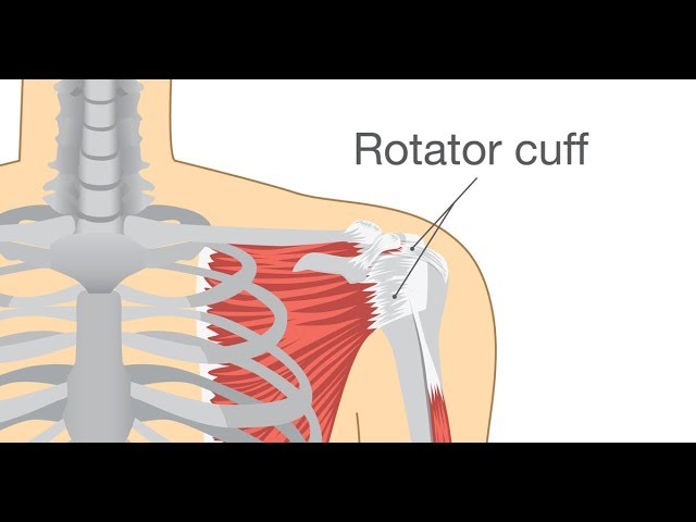 Common Signs of a Rotator Cuff Tear and How They Are Treated