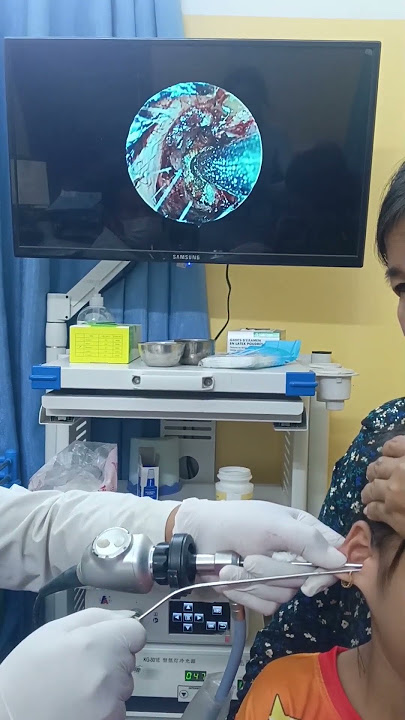 You Won’t Believe What’s Inside Your Ear 👂😱 #ENT #DoctorLife #EarExam