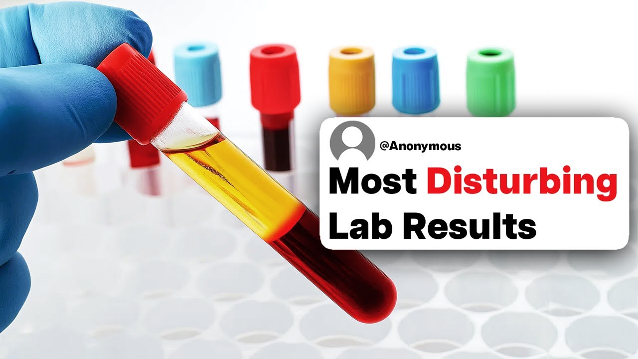 Doctors & Nurses, What's The Most Disturbing Lab Result You've Seen In A Patient?