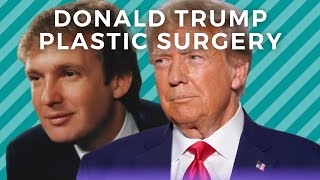 Donald Trump's Ex-Wife Revealed His Plastic Surgery Secret