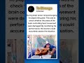 Man Plays Guitar During Brain Surgery