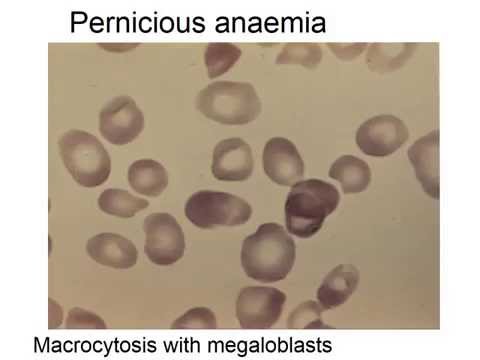 Hypoxia 24, Causes and Classification.