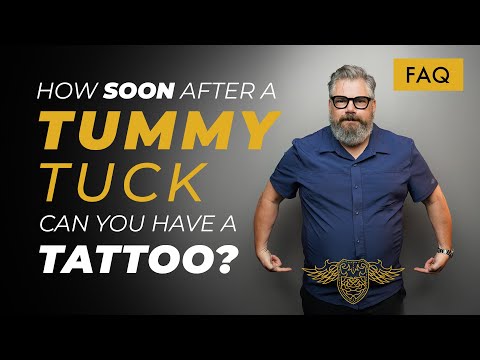 Ink After Incisions: When Can I Tattoo Post-Laparoscopic Surgery? - ScienceSphere.blog