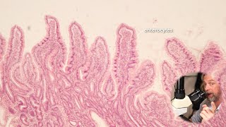 Histología del intestino delgado