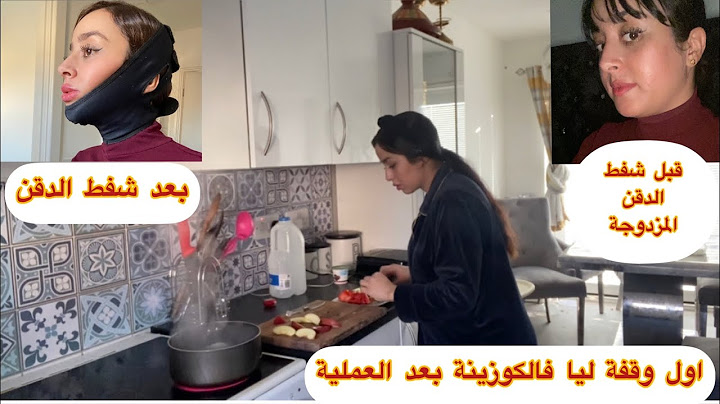 اول وقفة ليا فالكوزينة،شوجدت؟ بكيت انا وراجلي فتركيا اش كان وقع ليا...😭عمليتي لدقن المزدوجة بتفاصيل