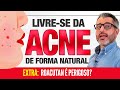 ACNE: como tratar as espinhas naturalmente 👉 🔴 👈