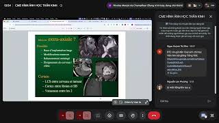 CME HÌNH ẢNH HỌC THẦN KINH 2026 07 17 P4