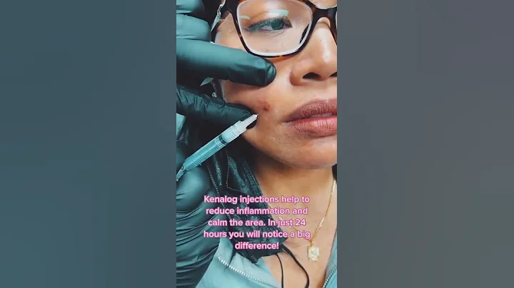 Cure to Cystic Acne FOUND 👁