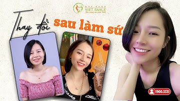 Bọc răng sứ thay đổi nụ cười - Thêm tự tin, nâng nhan sắc