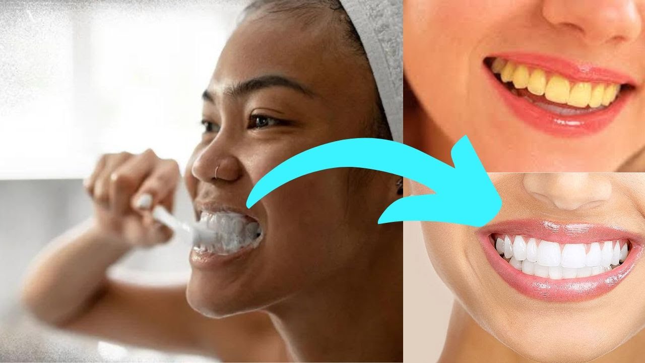 Whiten Your Teeth Naturally Ultimate Home Remedy Tooth Whitening YouTube