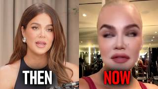 Khloe Kardashian Got A BRAND NEW Face