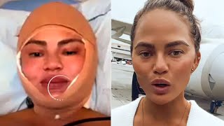 Chrissy Teigen Looks Unrecognizable In New Photos