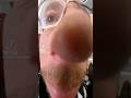 Big Nose Man
