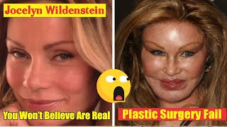 Jocelyn Wildenstein (Plastic Surgery Fail)- You Won’t Believe Are Real-Trend Facts