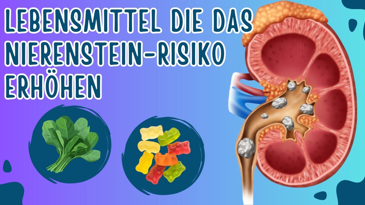 6 Lebensmittel, die das Risiko von Nierensteinen erhöhen - YouTube