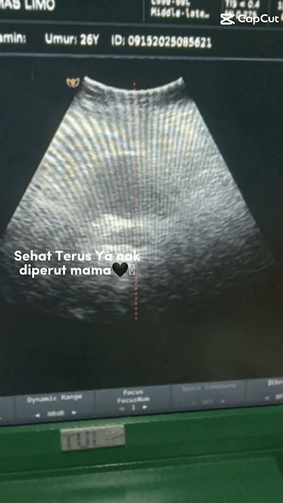 sehat sehat ayang diperut nda nak