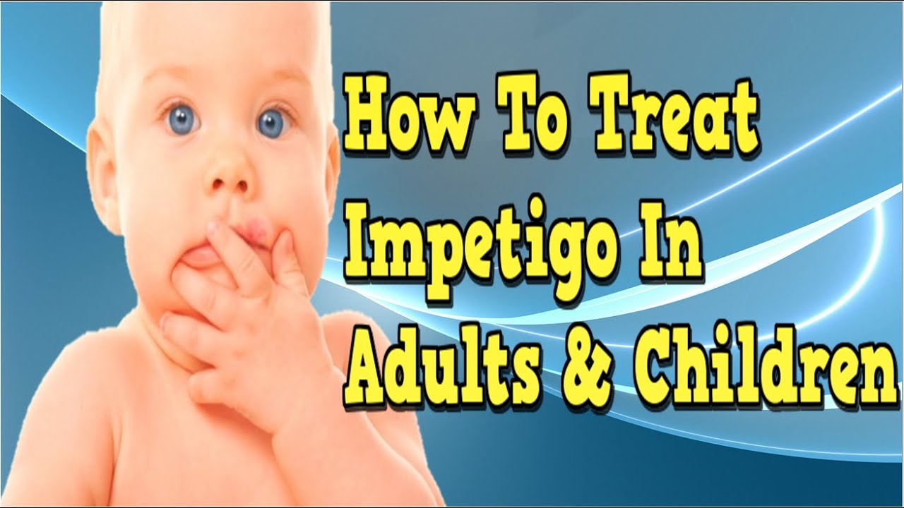 How To Treat Impetigo Impetigo In Adults Impetigo In Children