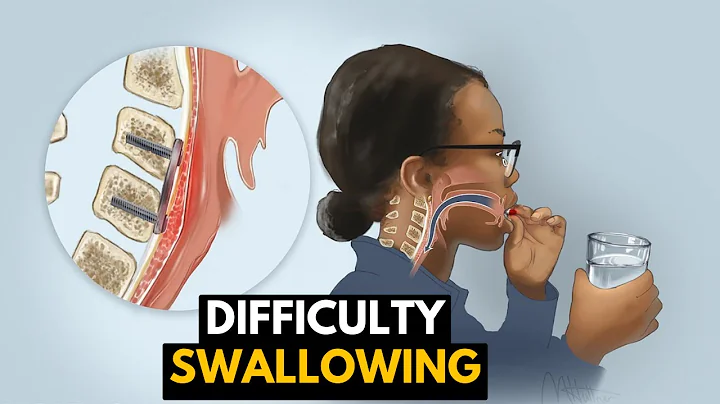 Struggling to Swallow? Understanding the Causes and Solutions - DayDayNews