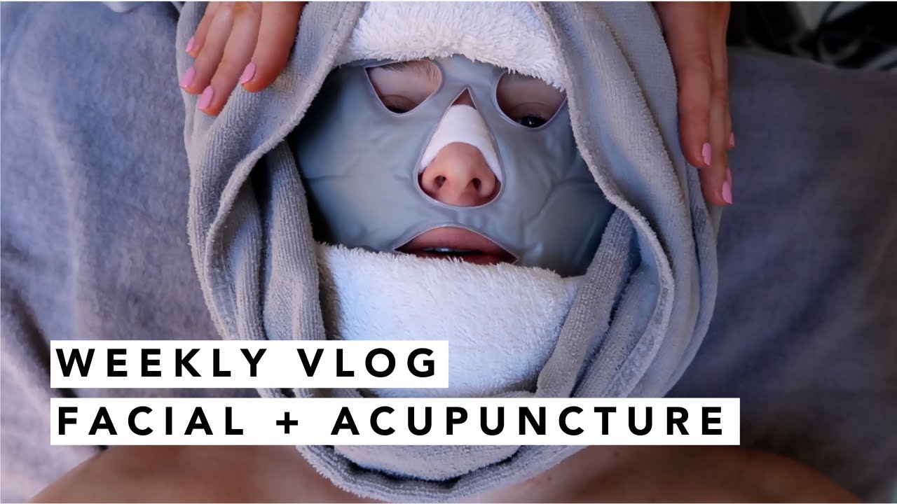 FACIAL, ACUPUNCTURE AND A VAGINA MUSEUM! | Estée Lalonde