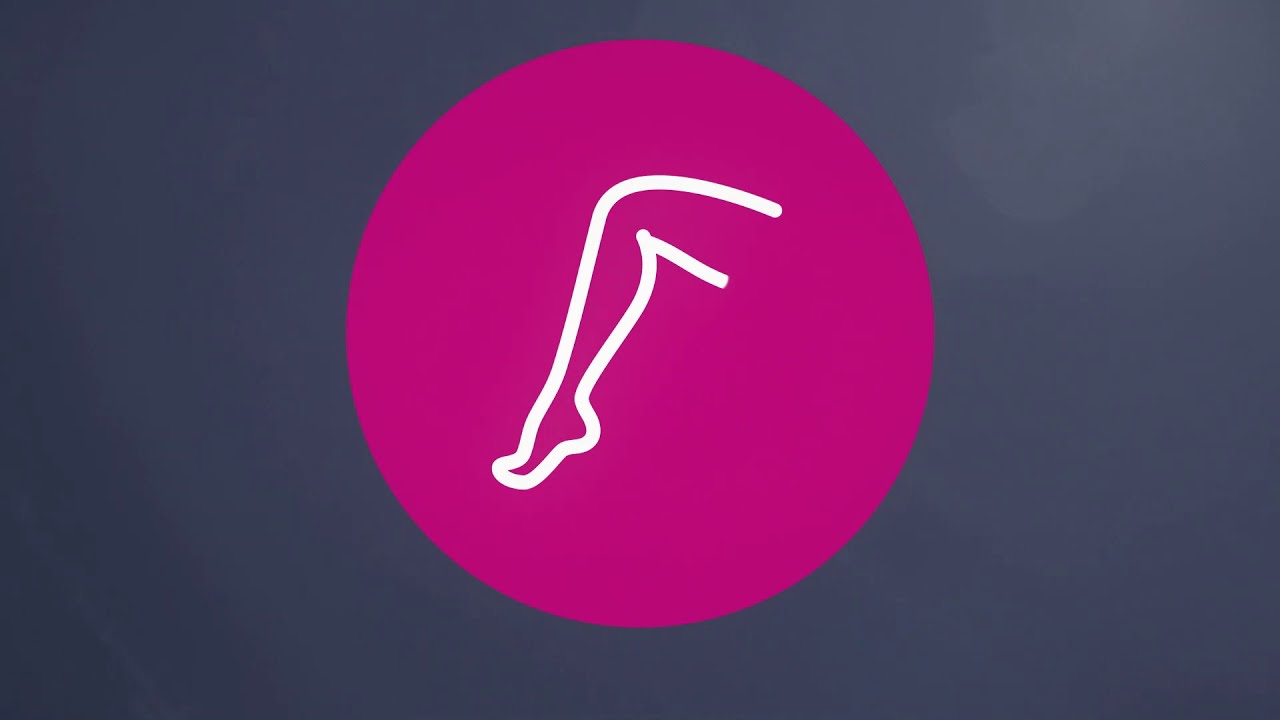 SONOVEIN S - echotherapie des varices - Sans incisions et sans cicatrice