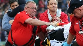 Fan hit in head by broken bat