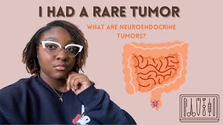 I Had a Rare Tumor Removed | Neuroendocrine Tumor Story