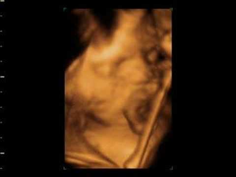wombo combo 4d baby scan of lisa and tony