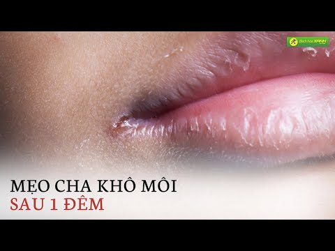 Video: 3 cách để ngăn ngừa môi khô nứt nẻ