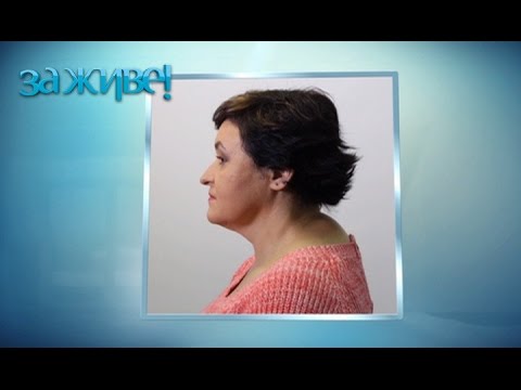 горб на шее как избавиться фото онлайн горб на шее как избавиться фото