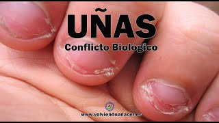 UÑAS 👉 Hongos, Frágiles, Encarnadas, Amarillas, Morderse las Uñas, Comerse las UÑAS © DBI