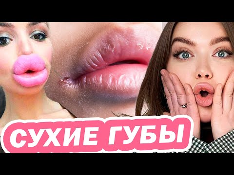 ЧТО СКРЫВАЮТ СУХИЕ ГУБЫ?