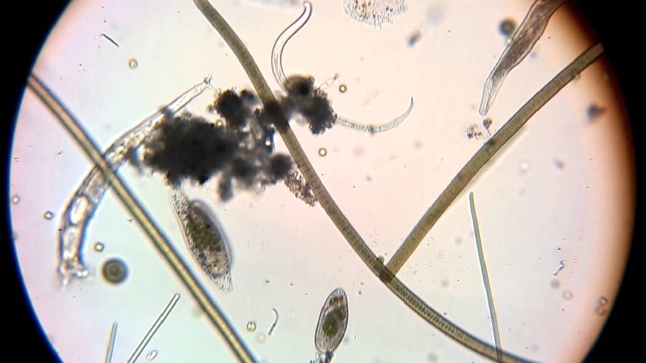Vida en las gotas de agua de una charca de Palma de Mallorca vistas al
