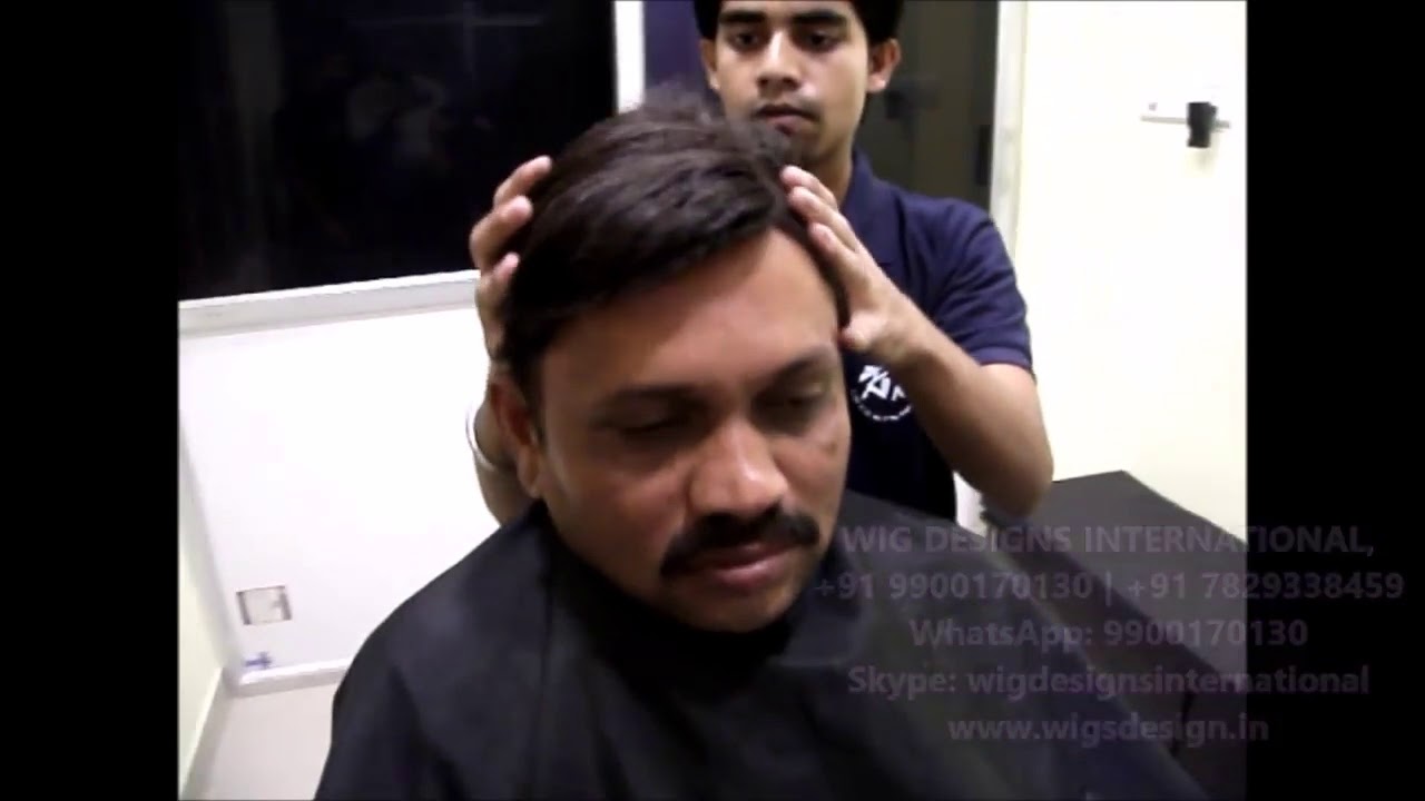 Non Surgical Hair Fixing for Mens Hair Loss 09900170130 Bangalore