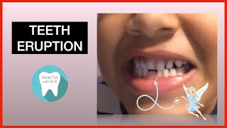 Teeth Eruption