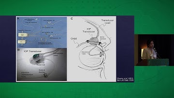 Measuring OPP with Continuous Radio Telemetry
